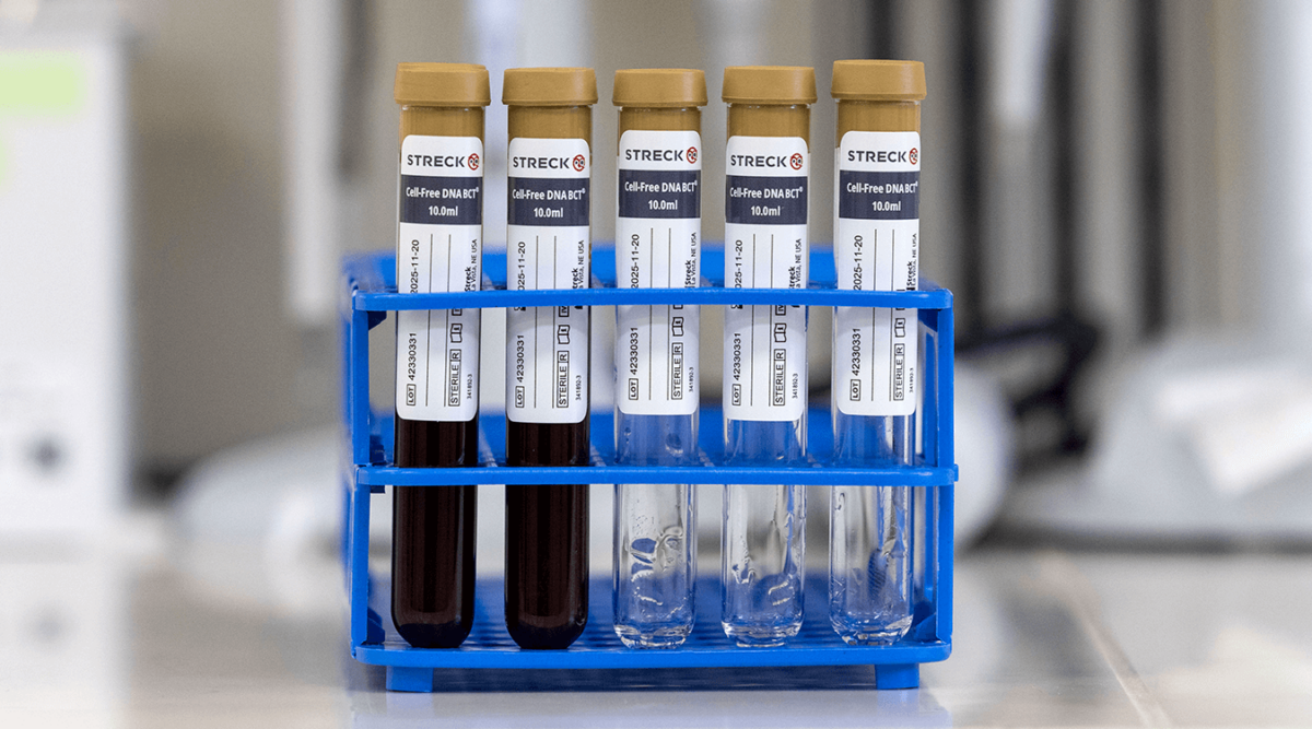 Multiple Cell-Free DNA BCT displayed in rack in a medical lab.